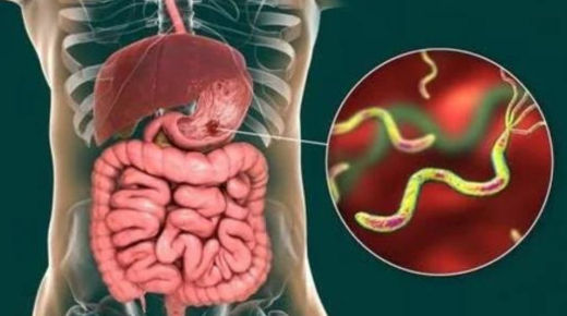 Unveiling the Connection - Can Stomach Ulcer Cause Diarrhea