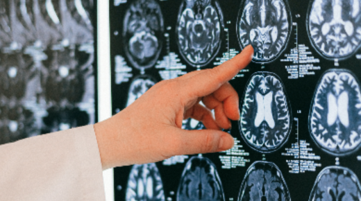Carolina Neurosurgery and Spine Huntersville - A Comprehensive Overview