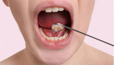 mouth cancer treatment in india